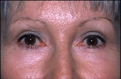 Patient 251 - Front View