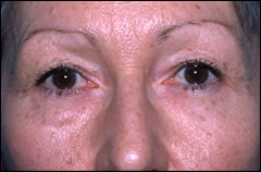 Patient 251 - Front View